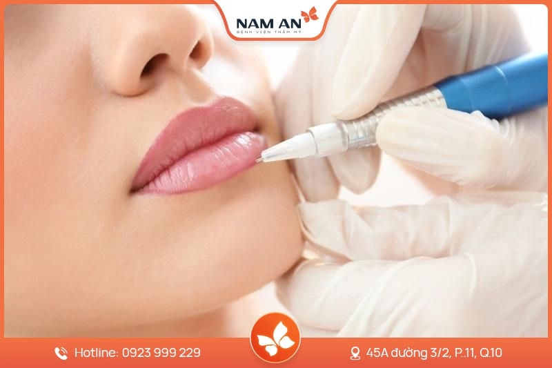 hút mực viền môi