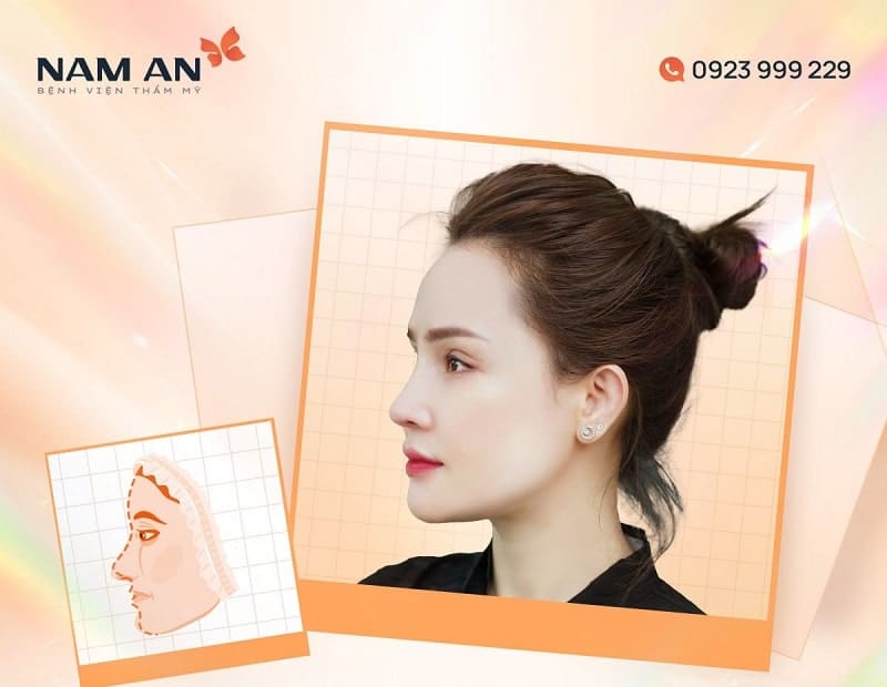 benh-vien-tham-my-cho-nguoi-viet-kieu-12