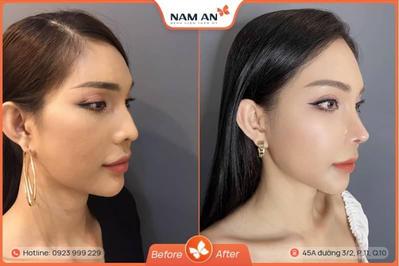 benh-vien-tham-my-cho-nguoi-viet-kieu-2