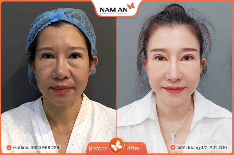 benh-vien-tham-my-cho-nguoi-viet-kieu-4