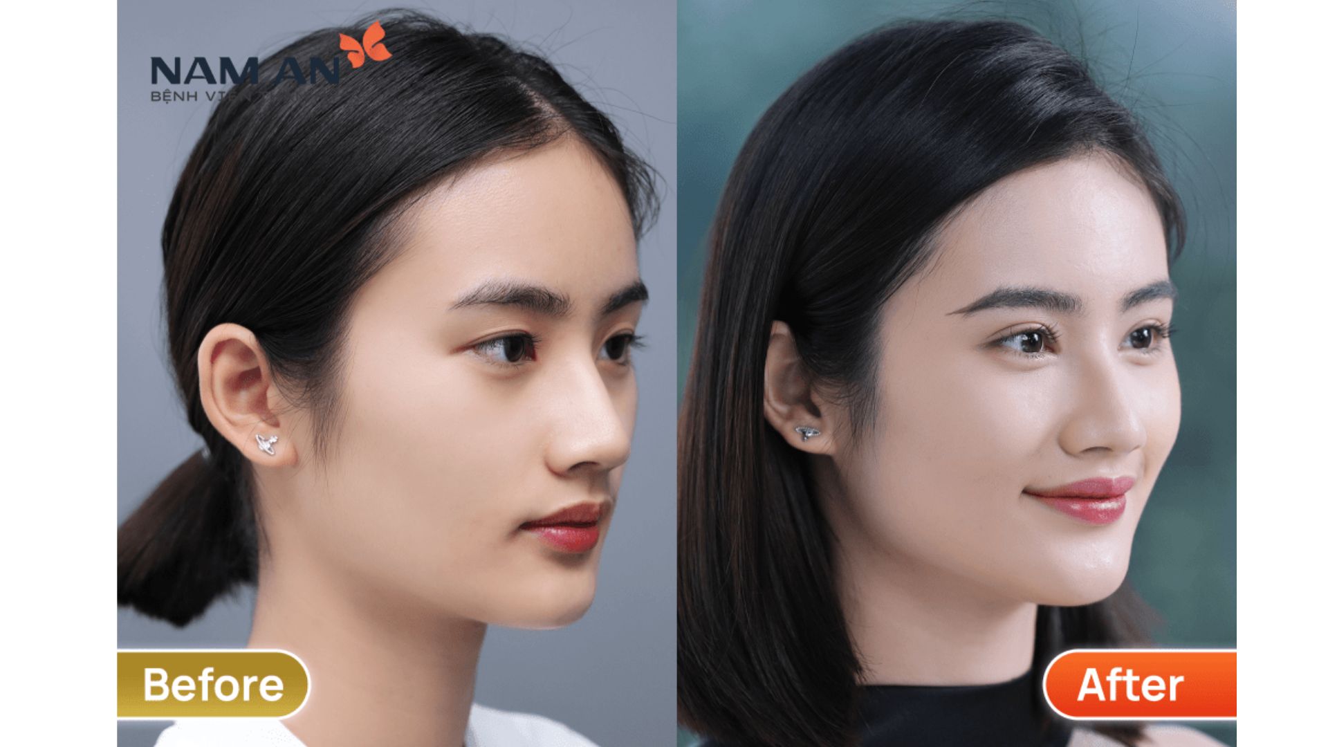 BS Đỗ Quang Khải Là Giảng Viên Tại ISAPS 2025 (7)