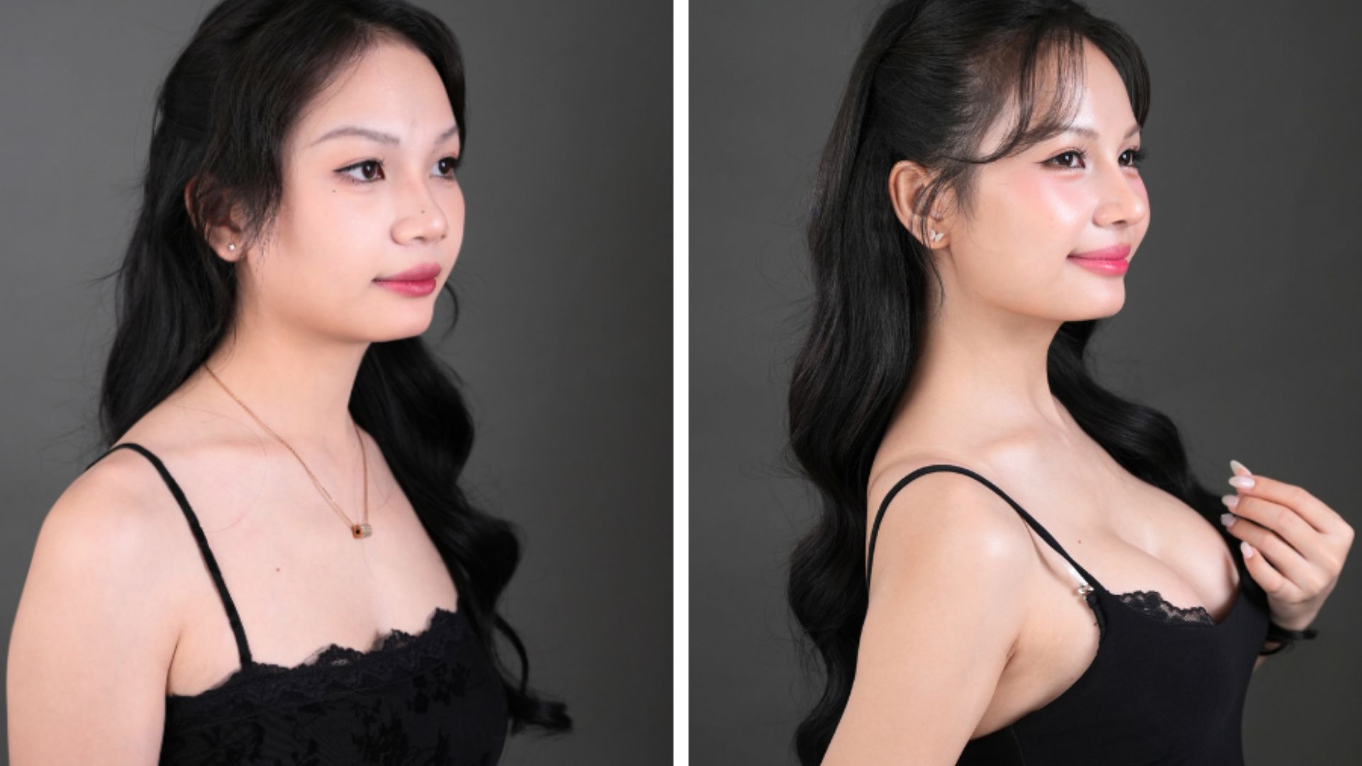 Bệnh viện Thẩm mỹ Nam An – nơi nhiều khách hàng tin tưởng lựa chọn (1)