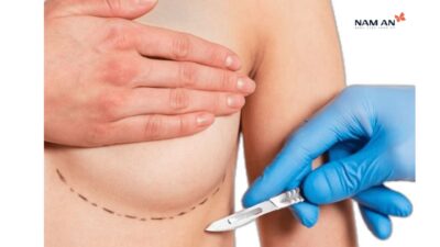 Bí Quyết Nâng Ngực Không Đau Tại Bệnh Vện Thẩm Mỹ Nam An