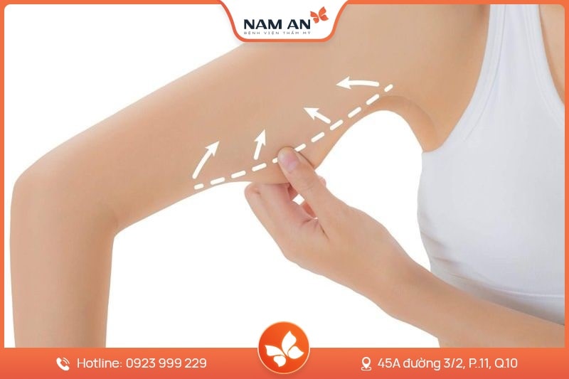 Căng Chỉ Da Mặt Trẻ Hóa, Nâng Cơ Toàn Diện Tại Nam An (3)