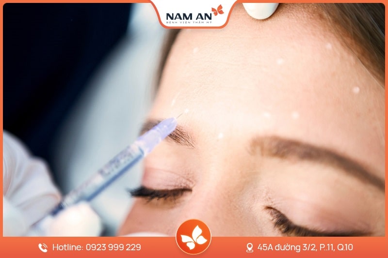 Căng Chỉ Da Mặt Trẻ Hóa, Nâng Cơ Toàn Diện Tại Nam An (5)