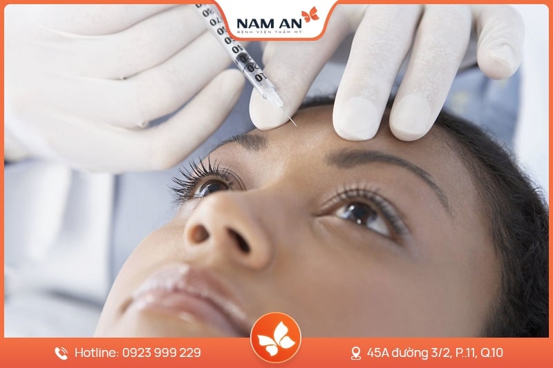 Căng Chỉ Da Mặt Trẻ Hóa, Nâng Cơ Toàn Diện Tại Nam An (8)