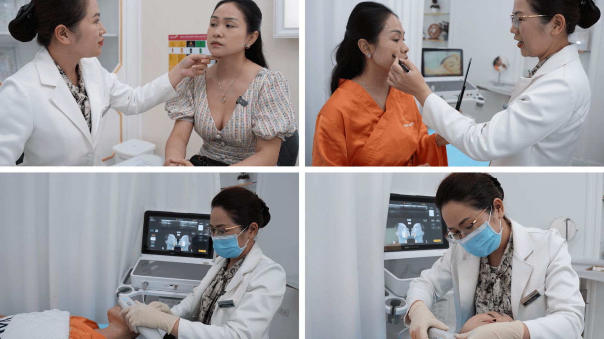 Căng Da Không Phẫu Thuật Với Ultherapy Prime Nam An (3)