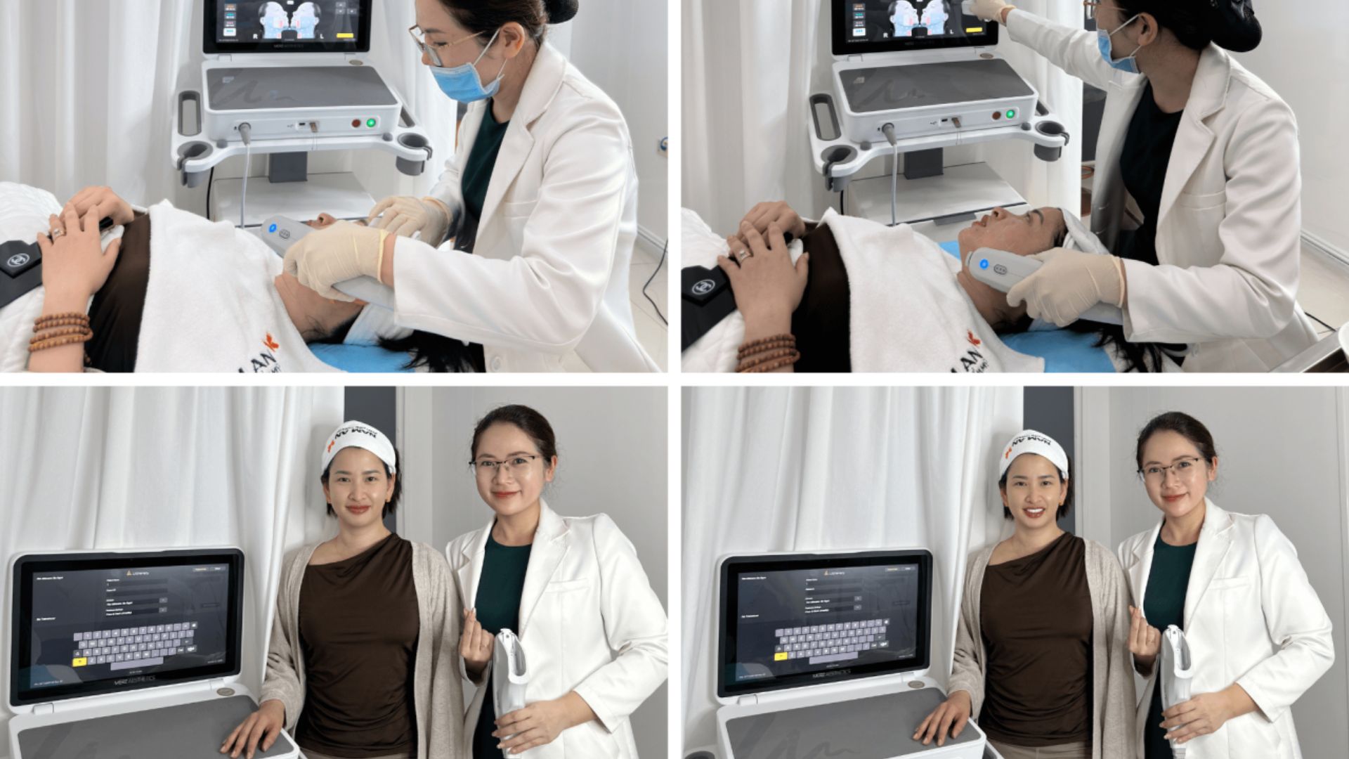 Căng Da Không Phẫu Thuật Với Ultherapy Prime Nam An (4)