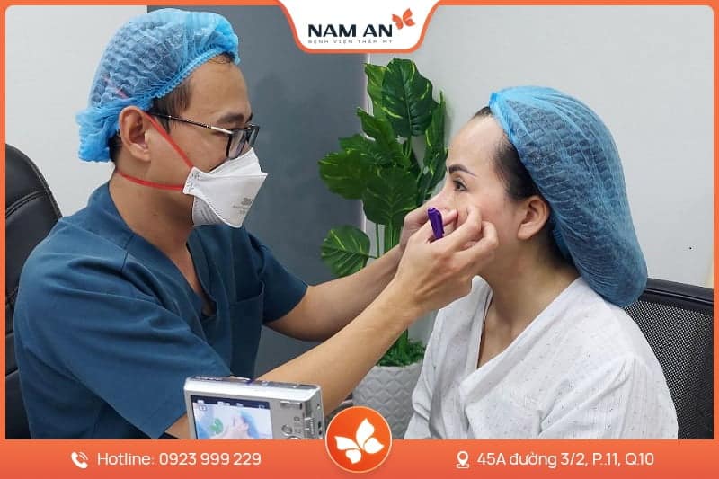 Căng Da Mặt Mini Midface Trẻ Hóa Tầng Giữa Tại Nam An (2)