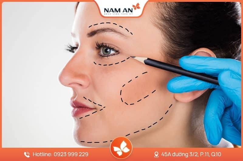 Căng Da Mặt Nội Soi Endoface Toàn Diện Tại BVTM Nam An