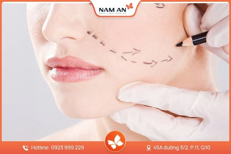 Căng Da Mặt Nội Soi Endoface Toàn Diện Tại BVTM Nam An