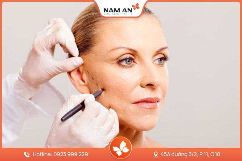 Chỉnh Sửa Căng Da Mặt Bị Hỏng Uy Tín Tại BVTM Nam An