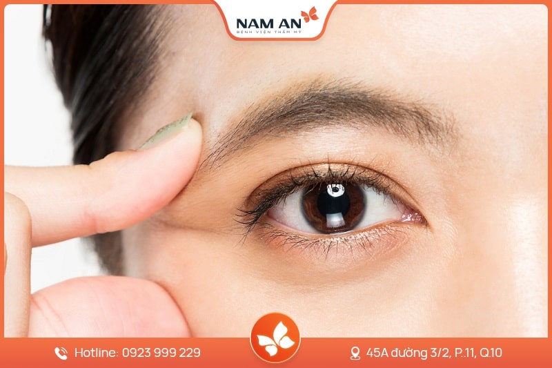 Chỉnh Sửa Mí Mắt Bị Hỏng Uy Tín Tại BV Thẩm Mỹ Nam An (2)
