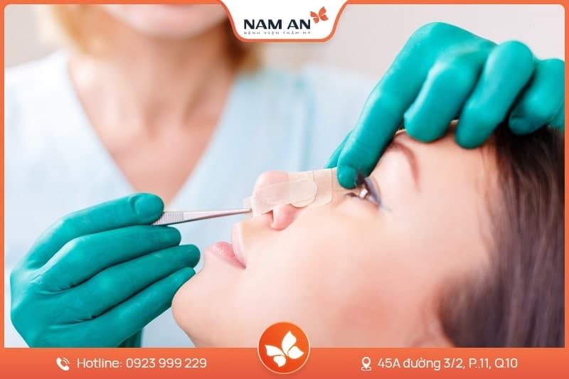 Chỉnh Sửa Mũi Hỏng Co Rút, Biến Dạng Tại BVTM Nam An (7)