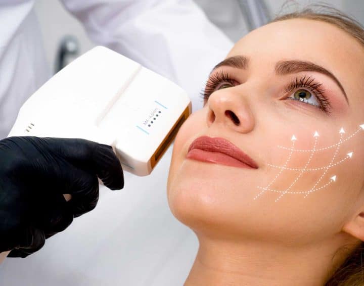 Chọn Thermage FLX Hay Ultherapy Prime Để Làm Đẹp Đón Tết (1)