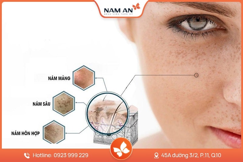 Công Nghệ HIFU Là Gì Trẻ Hóa Da Bằng HIFU Có Tốt Không (2)