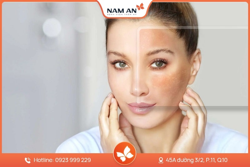 Công Nghệ HIFU Là Gì Trẻ Hóa Da Bằng HIFU Có Tốt Không (4)