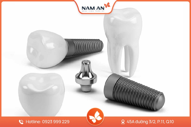 Dịch Vụ Cấy Ghép Trồng Răng Implant Uy Tín Tại Nam An (3)