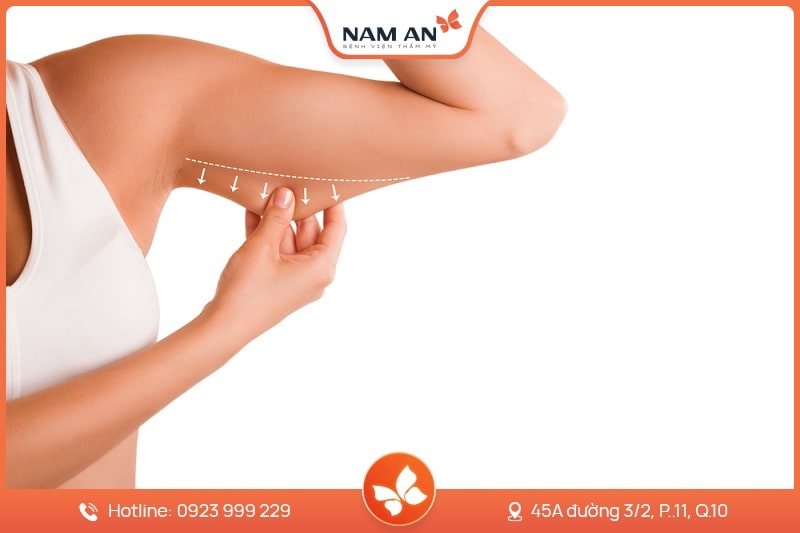 Dịch Vụ Hút Mỡ Toàn Thân An Toàn Tại BVTM Nam An (11)