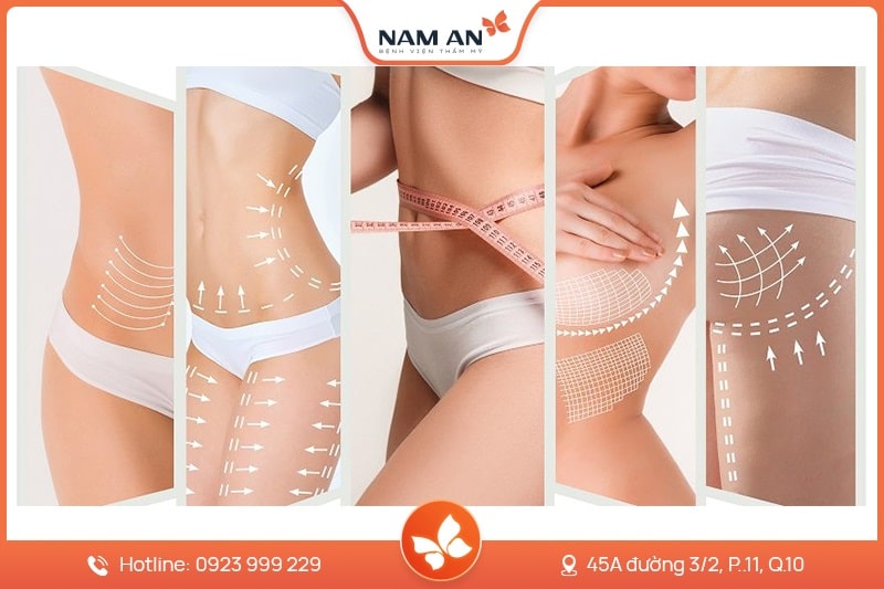 Dịch Vụ Hút Mỡ Toàn Thân An Toàn Tại BVTM Nam An (13)
