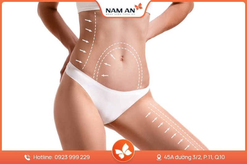 Dịch Vụ Hút Mỡ Toàn Thân An Toàn Tại BVTM Nam An (5)