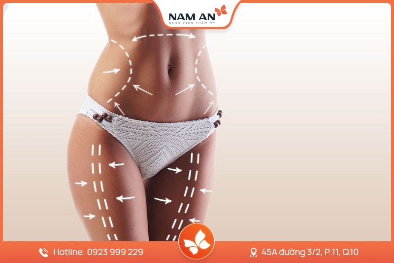 Dịch Vụ Hút Mỡ Toàn Thân An Toàn Tại BVTM Nam An