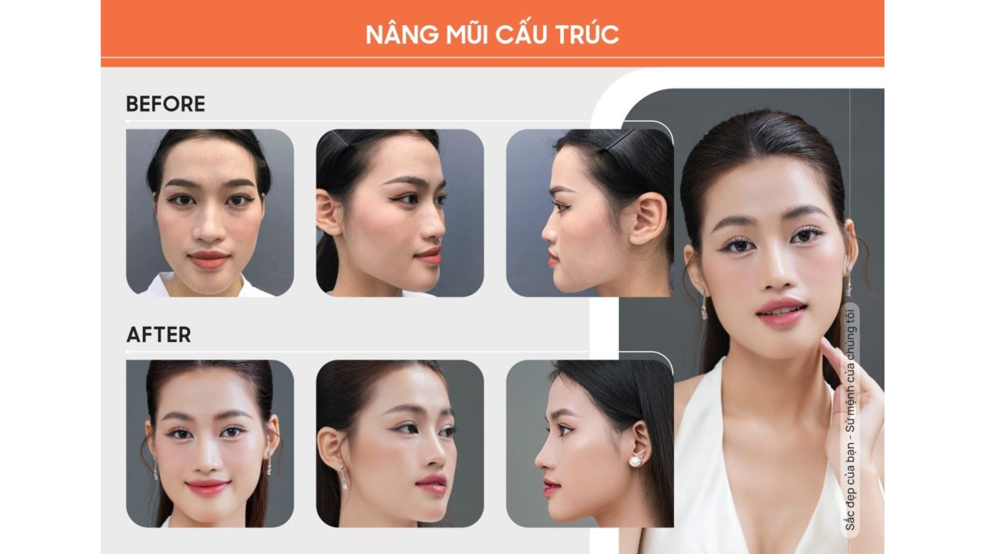Dịch Vụ Làm Đẹp Cấp Tốc Đón Tết Rạng Ngời (1)