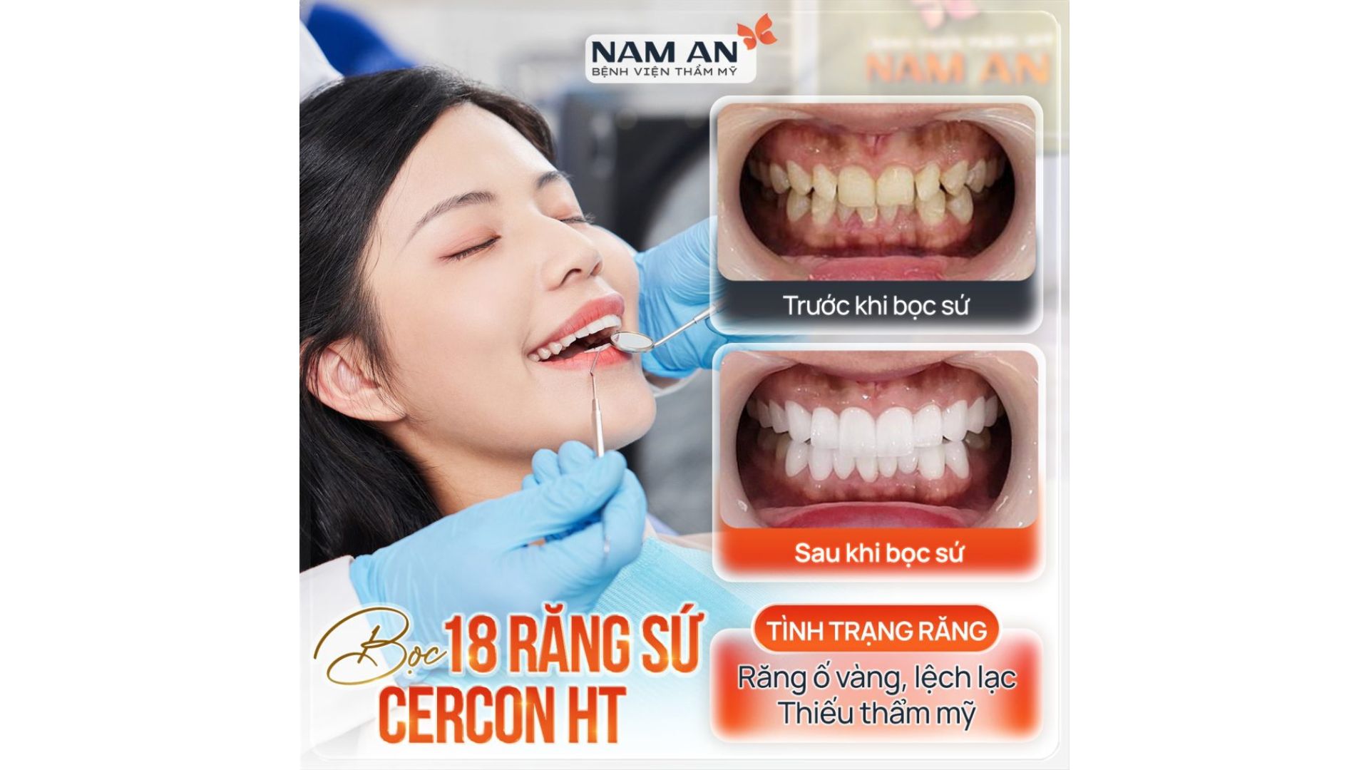 Dịch Vụ Làm Đẹp Cấp Tốc Đón Tết Rạng Ngời (3)