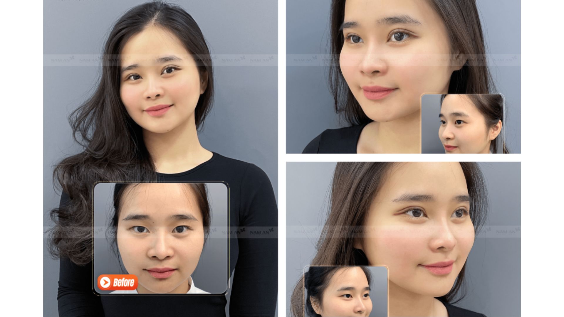 Dịch Vụ Làm Đẹp Cấp Tốc Đón Tết Rạng Ngời (6)