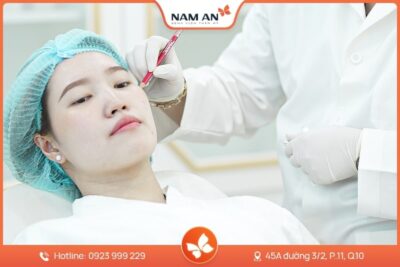 Căng Chỉ Da Mặt Trẻ Hóa, Nâng Cơ Toàn Diện Tại Nam An