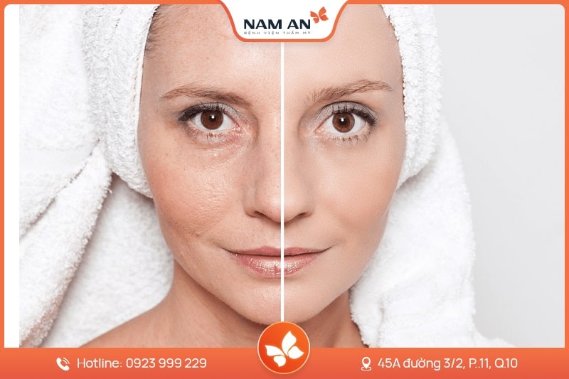 Dịch Vụ Tiêm Filler Thẩm Mỹ An Toàn Tại BVTM Nam An (3)