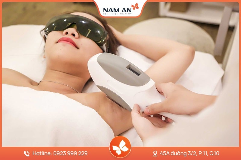 Dịch Vụ Triệt Lông Vĩnh Viễn Công Nghệ Cao Tại Nam An (1)