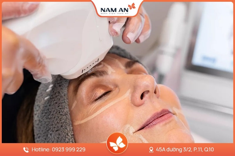 Điều Trị Mụn Công Nghệ Cao Chuẩn Y Khoa Tại BV Nam An (1)