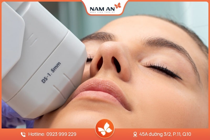 Điều Trị Mụn Công Nghệ Cao Chuẩn Y Khoa Tại BV Nam An (11)
