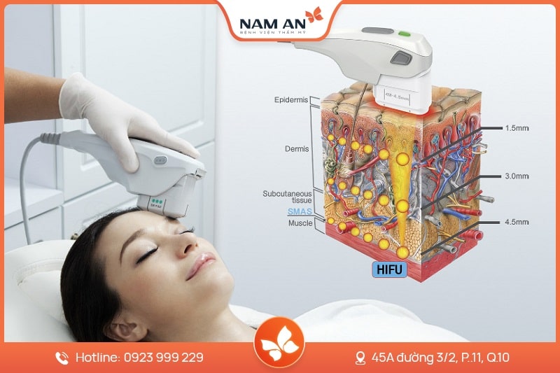 Điều Trị Mụn Công Nghệ Cao Chuẩn Y Khoa Tại BV Nam An (3)
