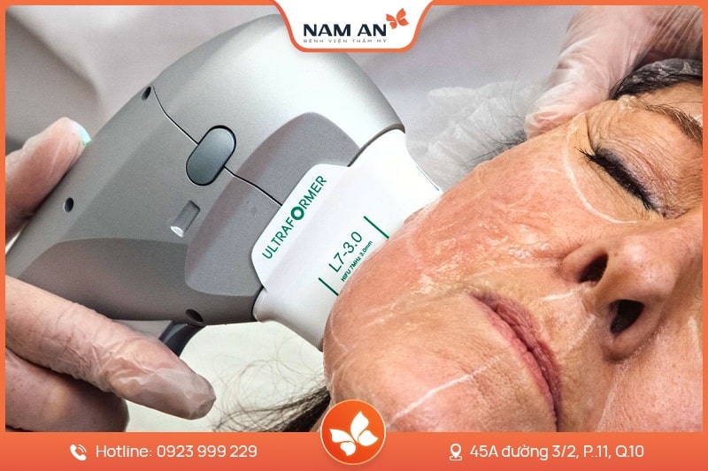 Điều Trị Mụn Công Nghệ Cao Chuẩn Y Khoa Tại BV Nam An (8)