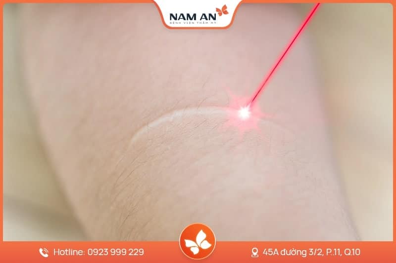 Điều Trị Nám Tận Gốc Bằng Công Nghệ Cao Tại BV Nam An (3)