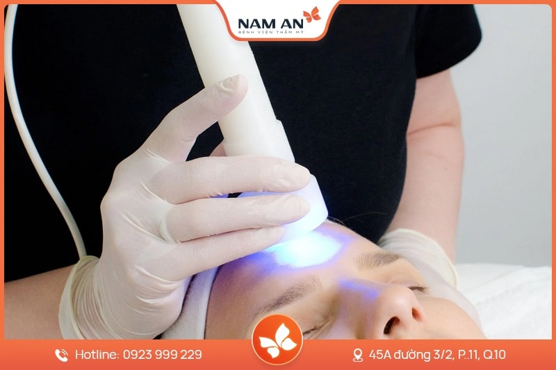 Điều Trị Tàn Nhang Dứt Điểm, Da Sáng Mịn Tại Nam An (12)