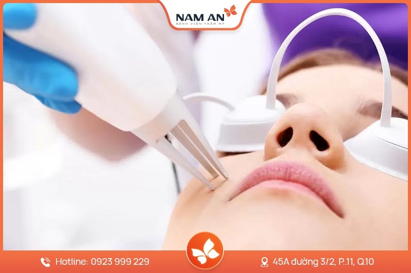 Điều Trị Tàn Nhang Dứt Điểm, Da Sáng Mịn Tại Nam An (8)