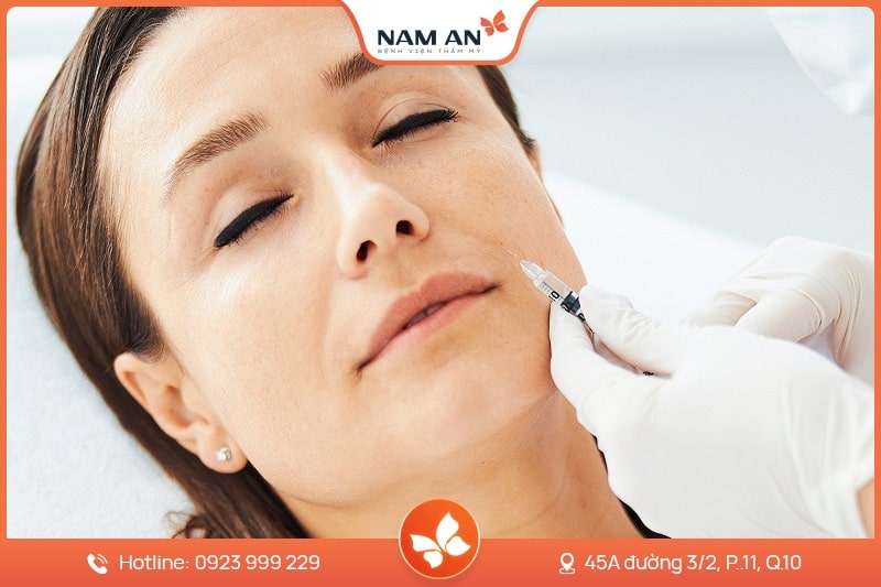 Độn Rãnh Mũi Má - Xóa Nếp Nhăn Trẻ Hóa Tại Nam An (3)