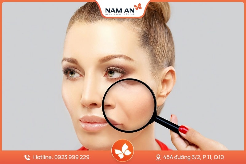 Độn Rãnh Mũi Má - Xóa Nếp Nhăn Trẻ Hóa Tại Nam An