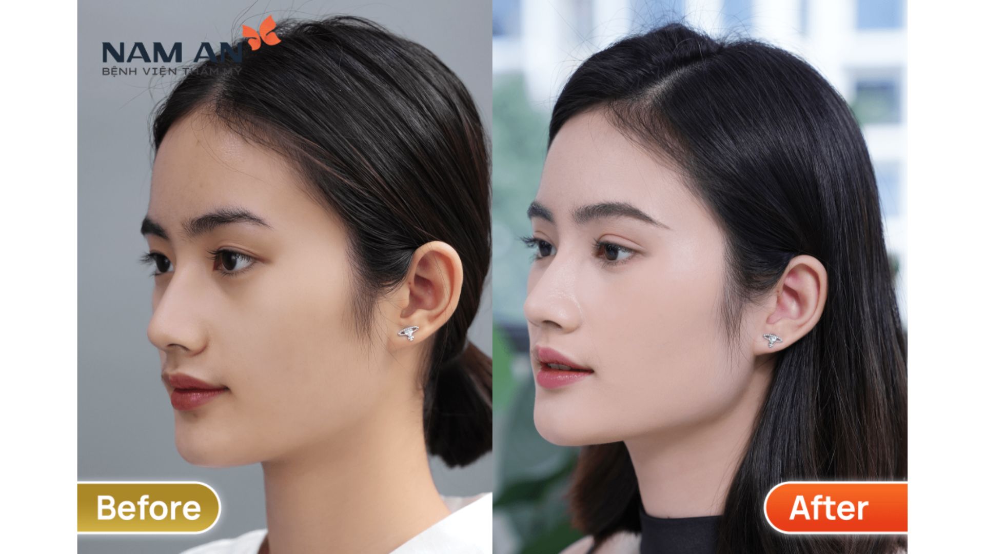 Hành Trình Hoa Hậu Ý Nhi Hoàn Thiện Tại Nam An (6)