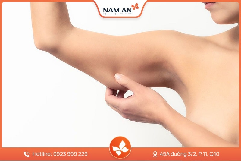 Hút Mỡ Bắp Tay Nhẹ Nhàng, Không Sẹo Tại BVTM Nam An (6)