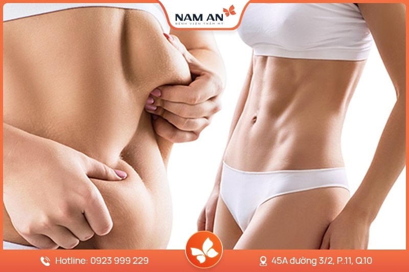 Hút Mỡ Bụng Công Nghệ Laser Lipo - Bệnh Viện Nam An (3)
