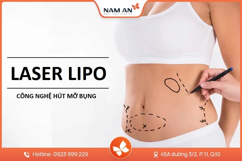 Hút Mỡ Bụng Công Nghệ Laser Lipo - Bệnh Viện Nam An (9)