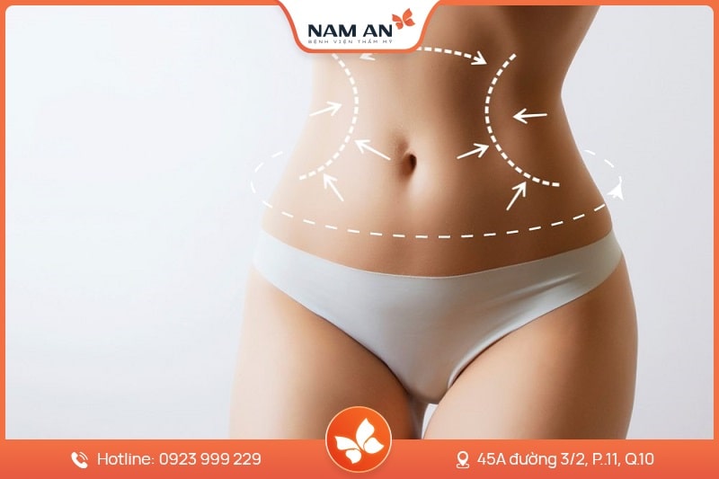 Hút Mỡ Bụng Công Nghệ Laser Lipo - Bệnh Viện Nam An