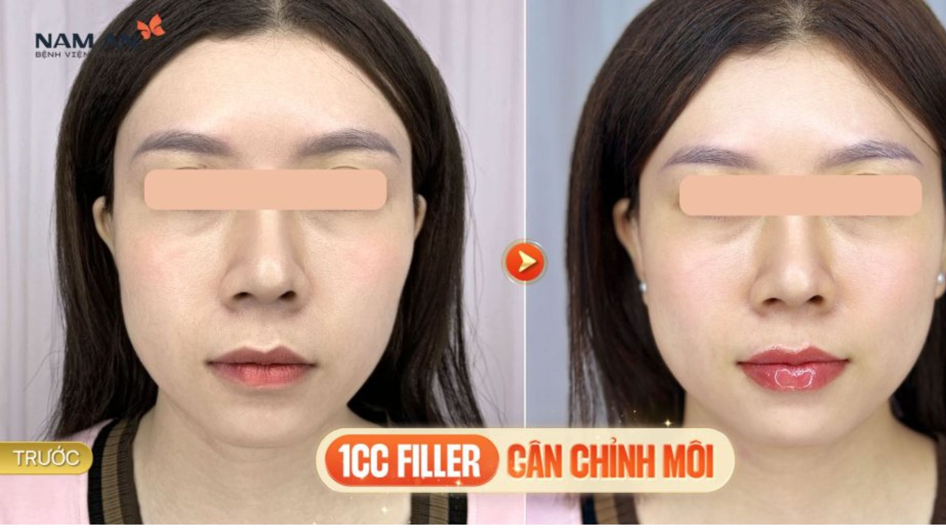 Kiều Bào Tin Tưởng Làm Đẹp Tại BVTM Nam An Cuối Năm (5)