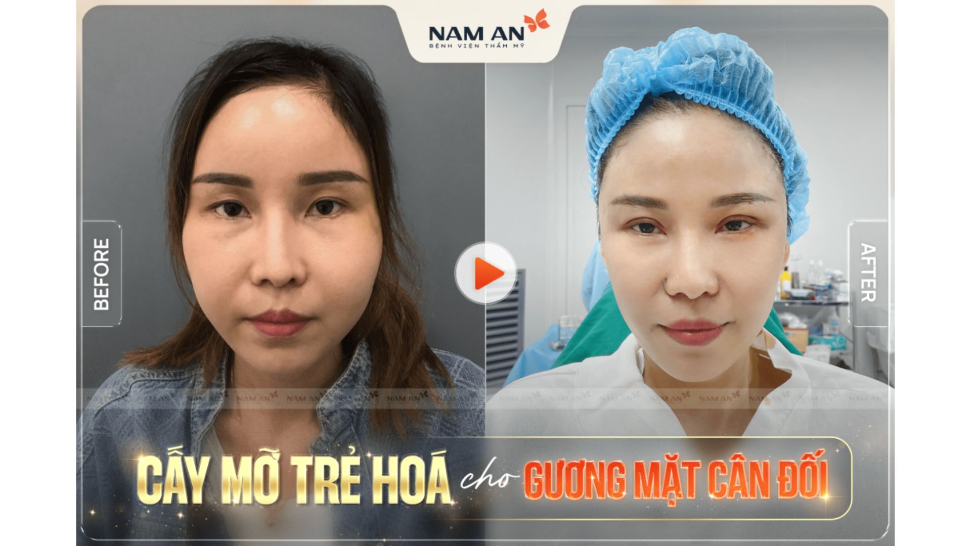 Kiều Bào Tin Tưởng Làm Đẹp Tại BVTM Nam An Cuối Năm (6)