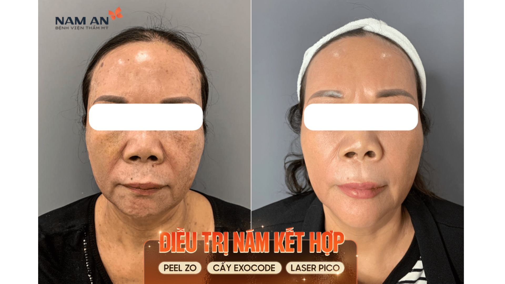 Kiều Bào Tin Tưởng Làm Đẹp Tại BVTM Nam An Cuối Năm (8)