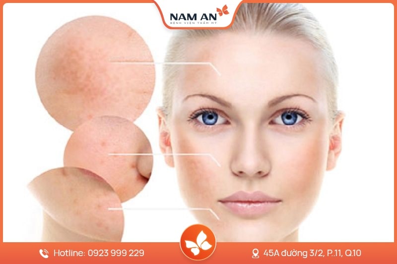 Liệu Trình Truyền Vitamin Trẻ Hóa Da Từ Bên Trong Tại Nam An (2)